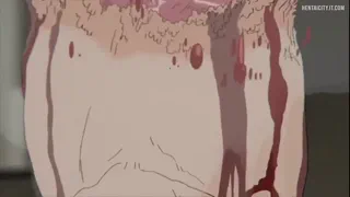An arm and a leg